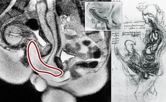MRI Under Sex