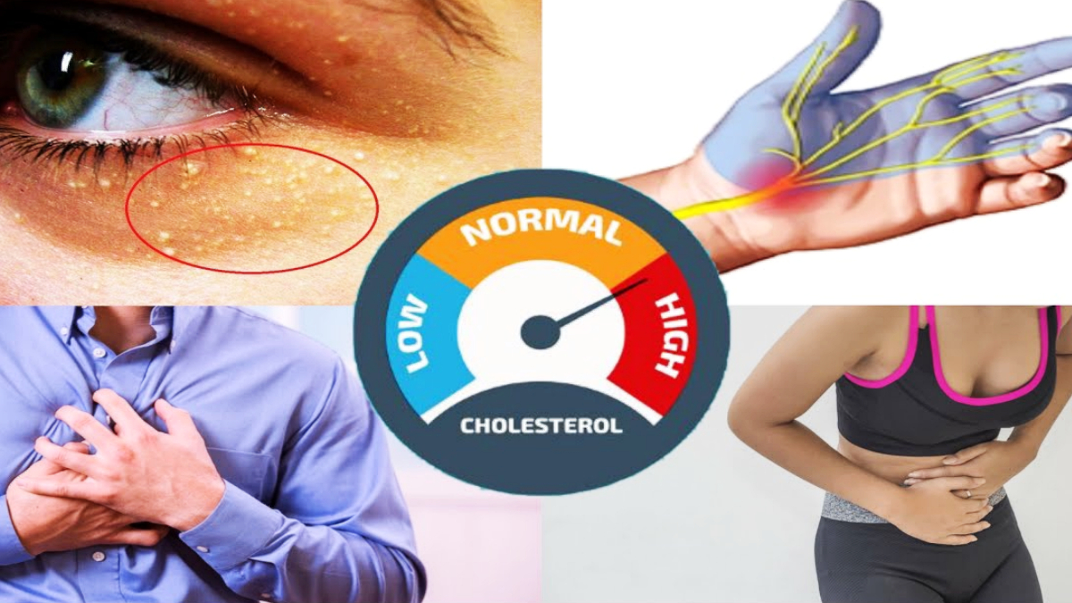 high cholesterol symptoms