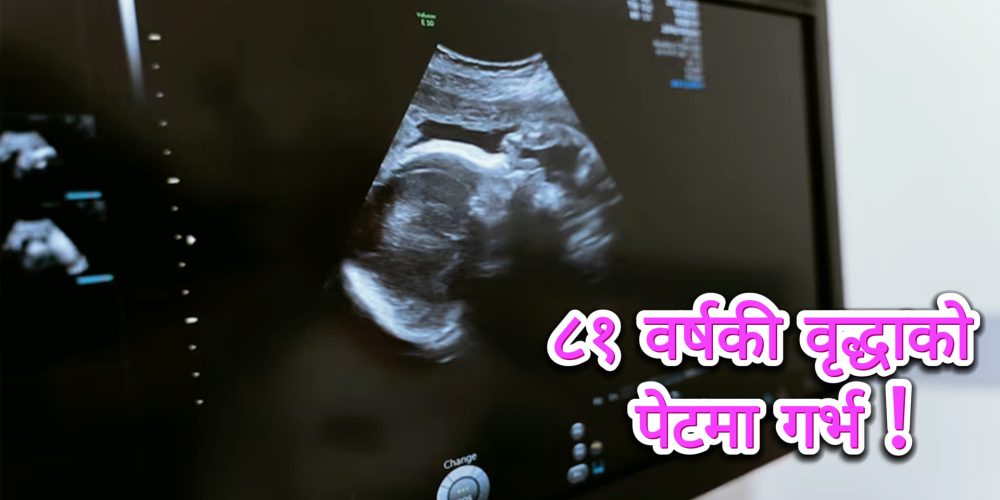 81-year-old woman's stomach pregnant!