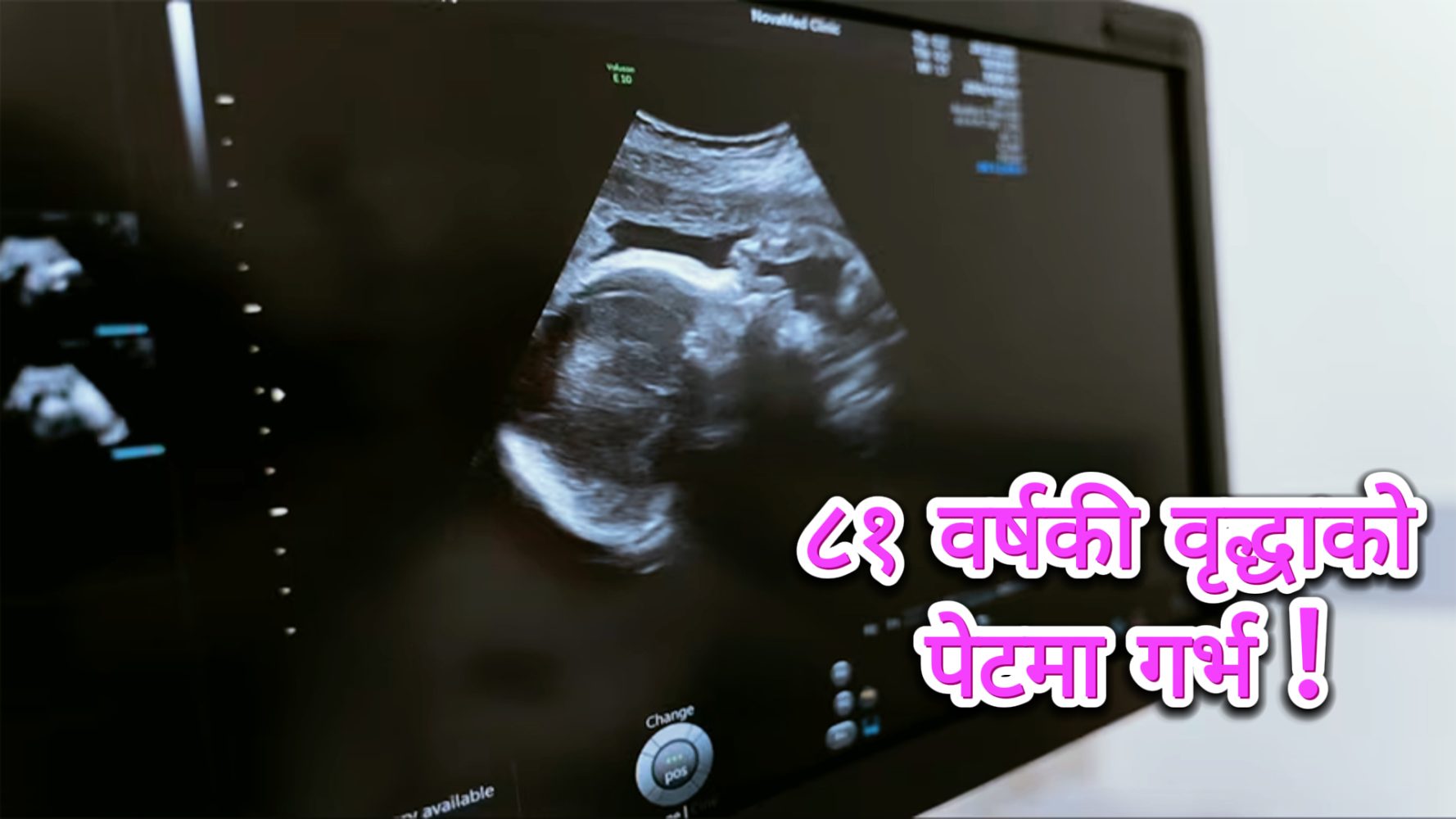 81-year-old woman's stomach pregnant!