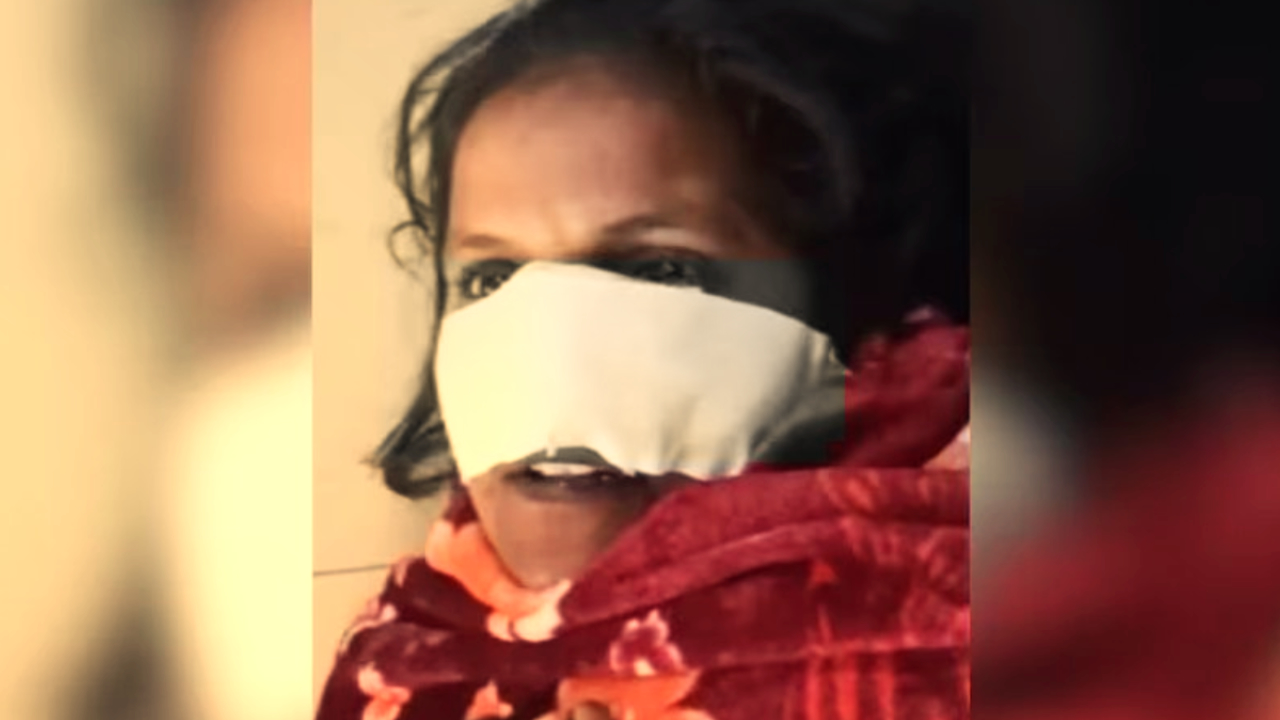 After the Husband Bit the Wife's Nose in a Public Place in Devalkha...